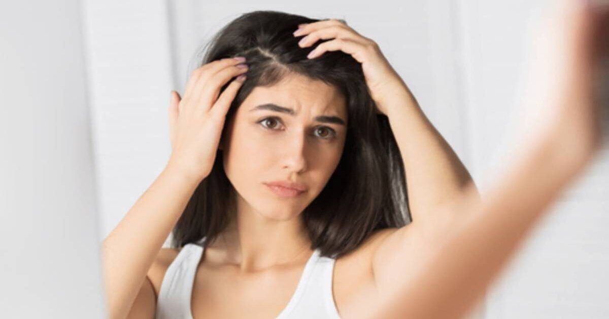 علاج أكزيما الشعر